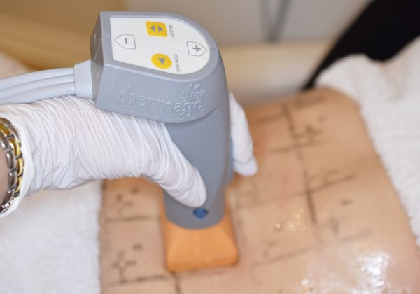 Thermage_entouch_2-600x420